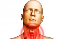 Лечение кашля при ларингите: как лечить ларингитный кашель